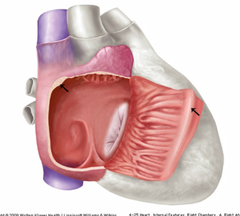 <p>identify the structure</p>