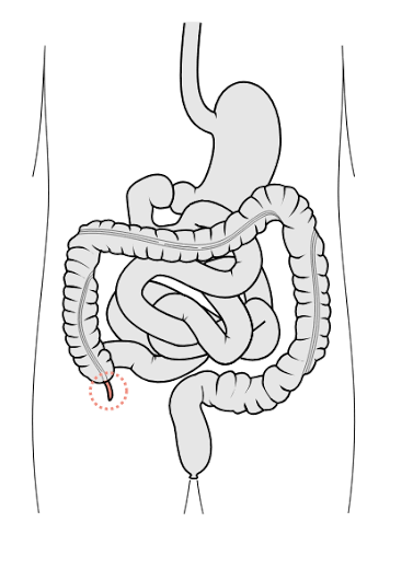 <p>red thing</p>