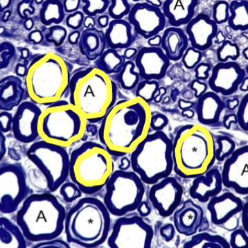 <p>What are the yellow circles pointing out?</p>