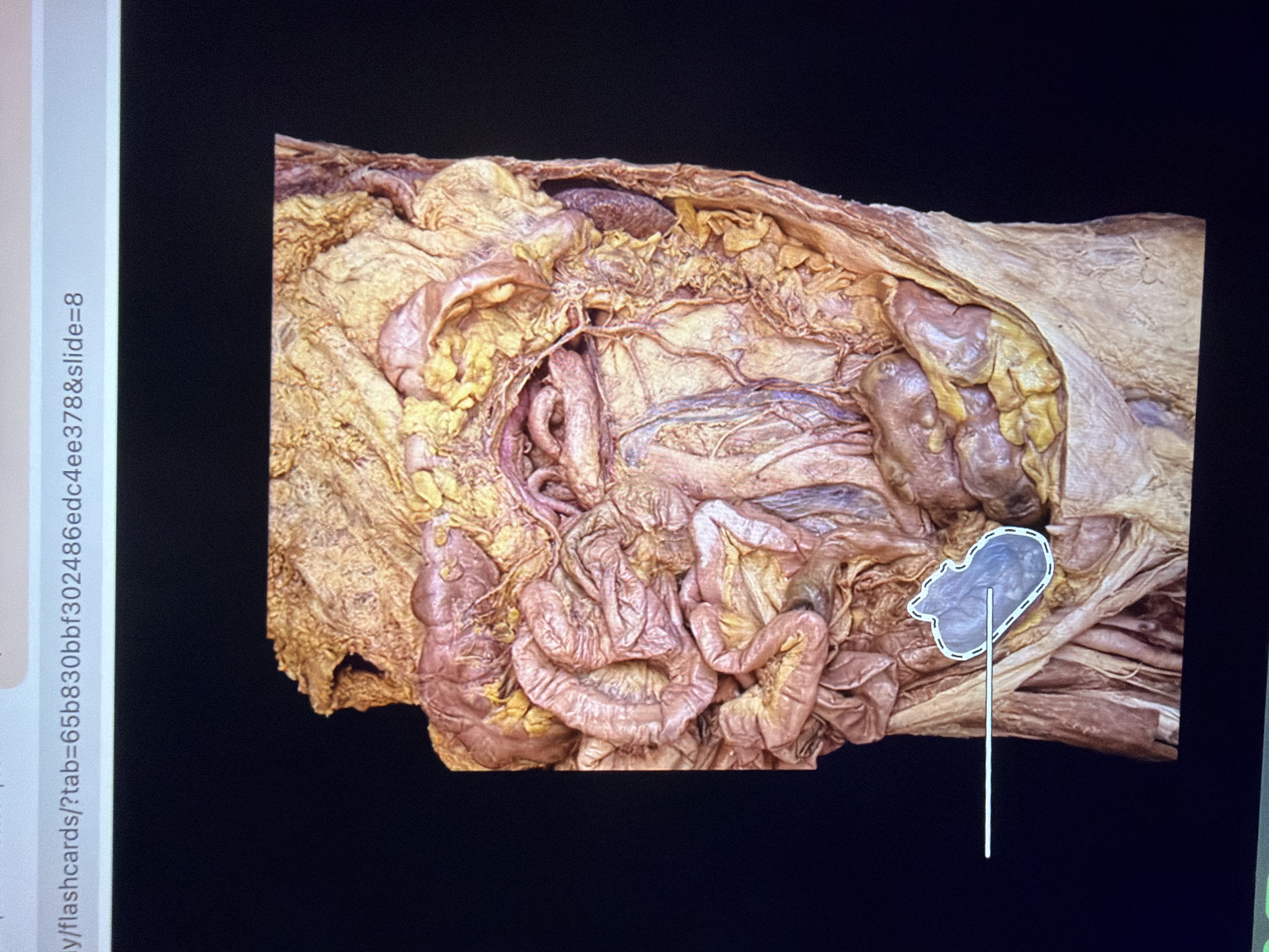 term image