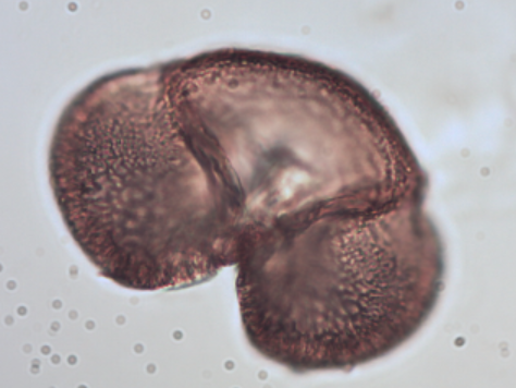 <p>Identify the pollen grains to the <strong>Family</strong> and <strong>Genus</strong></p>
