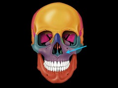 <p>rest of the maxillary bone that does not have a structural name</p>