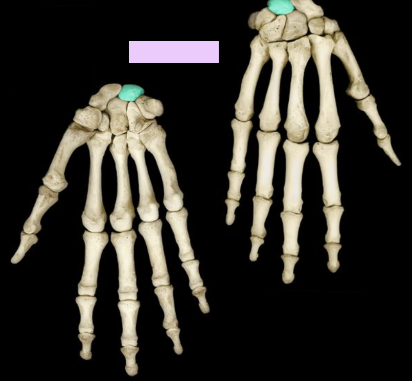 <p>What structure is highlighted?</p>
