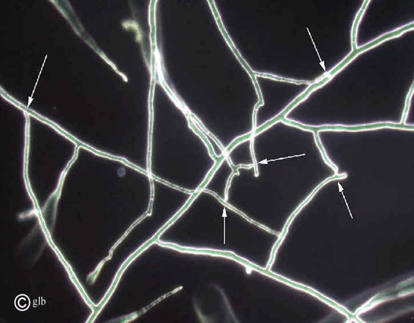 <p>if hyphae have  <span><em><u><span>no</span></u></em><span> separating membrane</span></span></p>