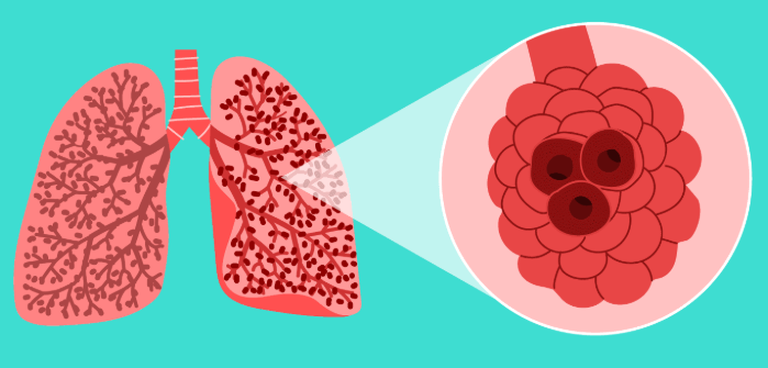 <p><span style="background-color: transparent;">The functional unit of the lung. Consists of small hollow areas for gas exchange. Both Alveoli and alveolar ducts are lined with simple squamous epithelium that allow for gas exchange.</span></p>