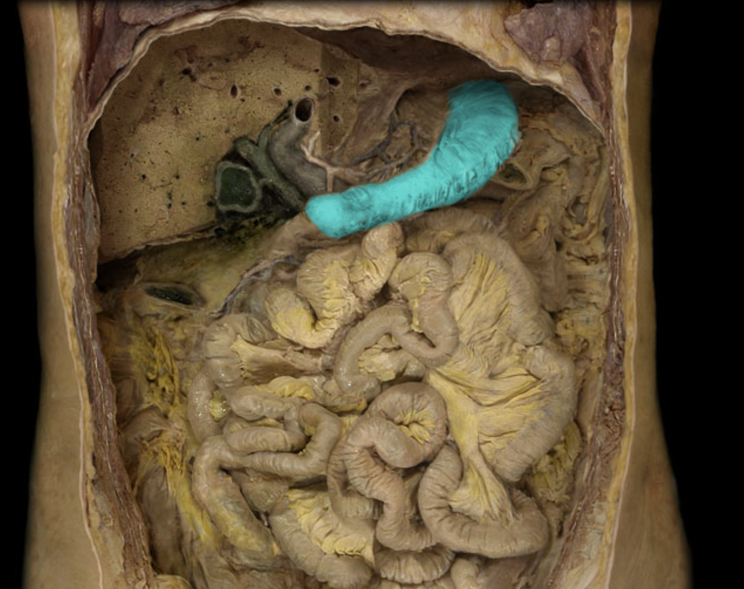 term image