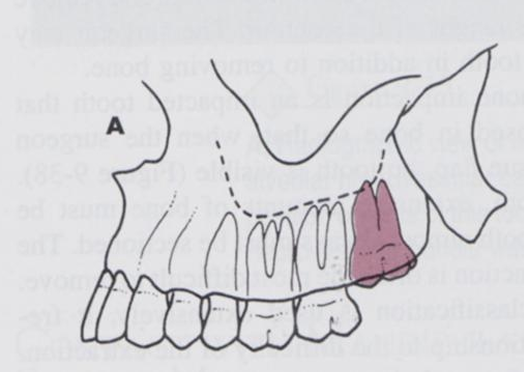 <p>what angle is this?</p>