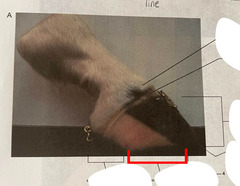 <p>What is the clinical significance of the quarter?</p>
