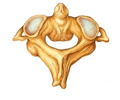 <p>disarticulated</p>