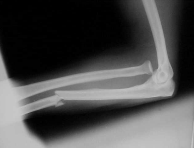 <p>bado 1 monteggia</p>