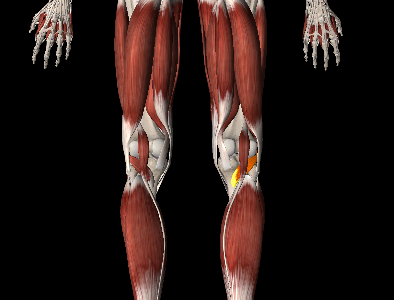 <p>What muscle is this?</p>