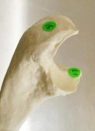 <p>15</p>