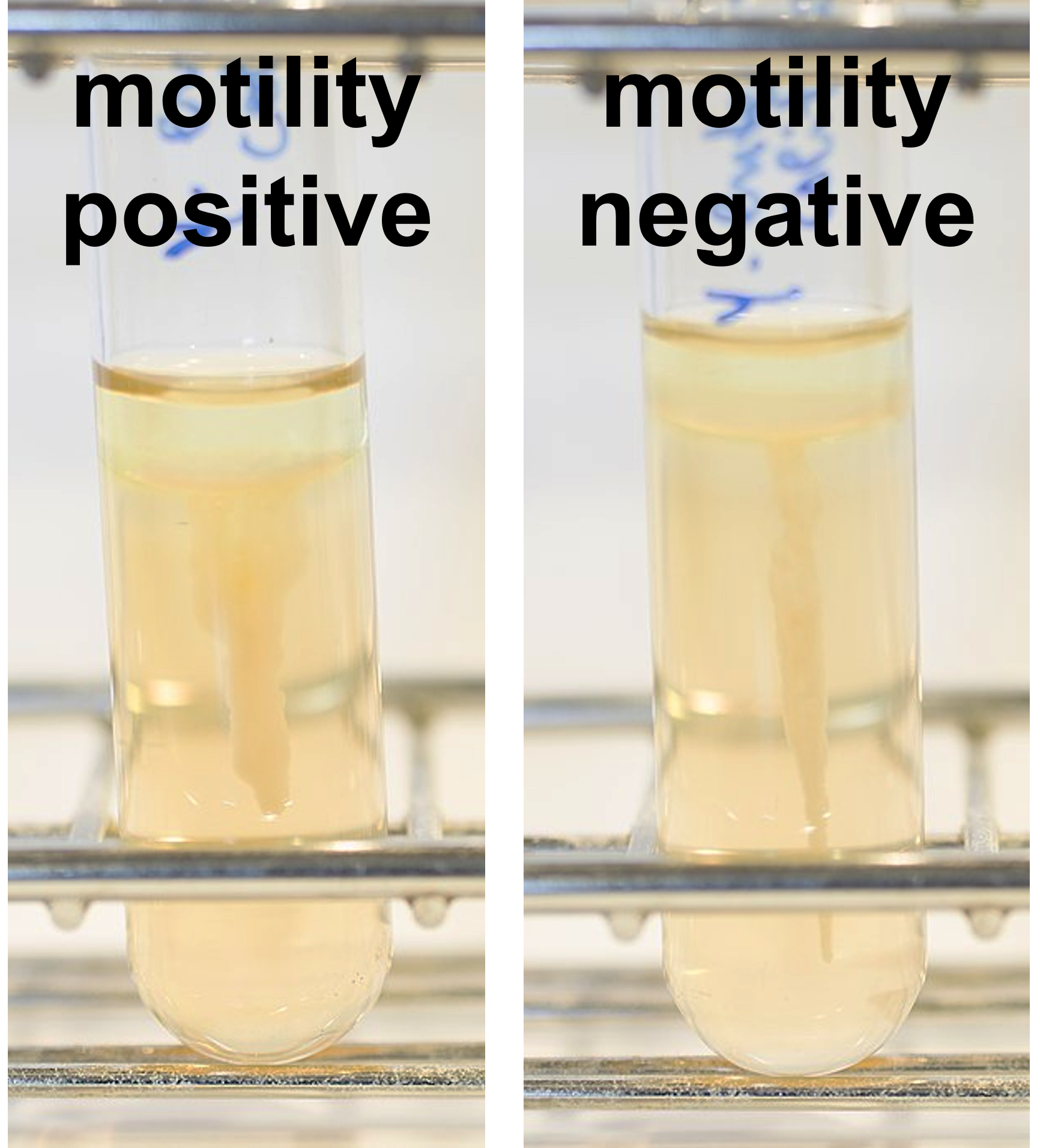 <p>What does a positive motility test mean?</p>