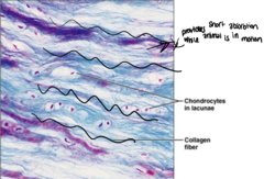 <p>What type of connective tissue is this?</p>