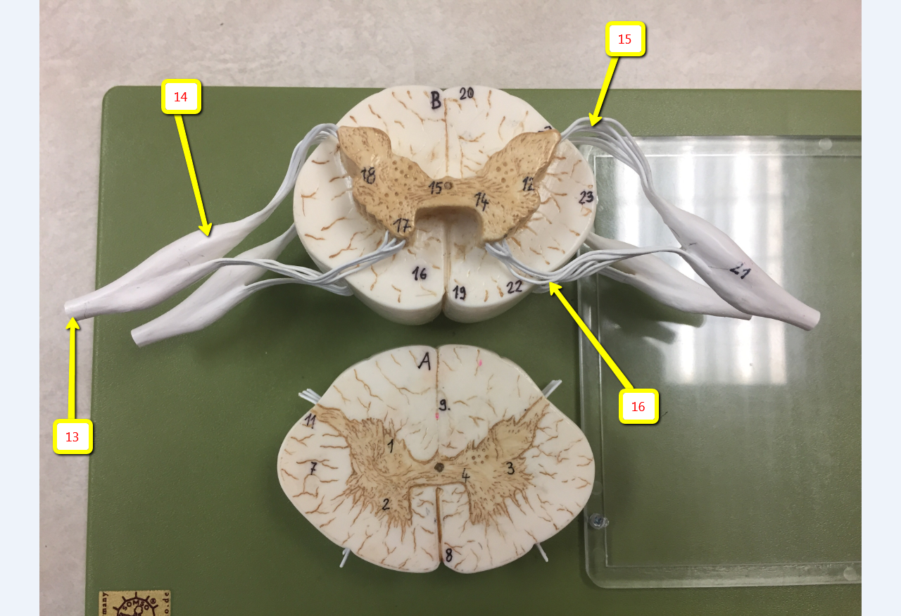 <p><span>Name the bulge indicated by arrow 14:</span></p>