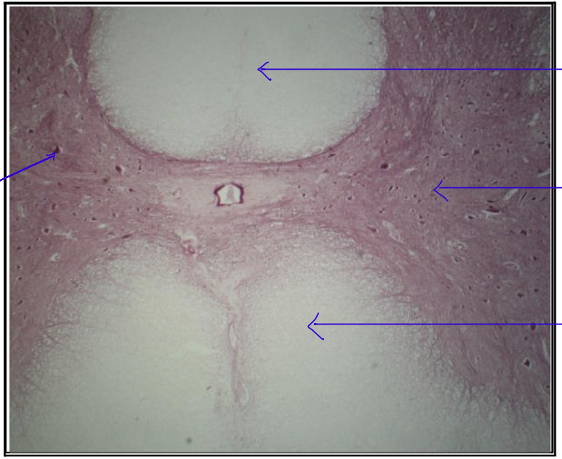 <p>a.) What is this organ?</p><p>b.) What is the parenchyma of the cell?</p><p>c.) How many nucleus?</p><p>d.) What is the stroma?</p><p>e.) What is the arrangement of the cell?</p><p>f.) location of the nucleus?</p><p>g.) Shape?</p>