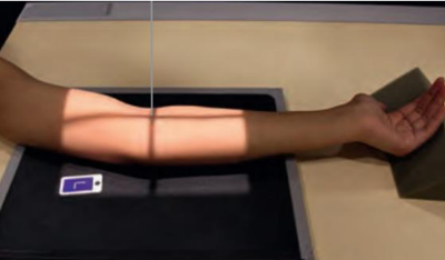 <p><strong>Position of patient:</strong></p><p> Seat the patient near the radiographic table</p><p> Shoulder joint, humerus, and elbow joint <mark data-color="yellow" style="background-color: yellow; color: inherit;">in the same plane</mark>.</p><p><strong>Position of part</strong></p><p> <mark data-color="red" style="background-color: red; color: inherit;">Extend the elbow, supinate the hand</mark>.</p><p> Have the patient <mark data-color="red" style="background-color: red; color: inherit;">lean laterally</mark> until the <strong>humeral epicondyles</strong> and</p><p><strong>anterior surface of the elbow</strong> are parallel with the plane of the IR.</p><p> <mark data-color="red" style="background-color: red; color: inherit;">Supinate the hand to prevent rotation</mark> of the bones of the</p><p>forearm.</p><p><strong>Central ray</strong></p><p> <strong><mark data-color="yellow" style="background-color: yellow; color: inherit;">Perpendicular to the elbow joint</mark></strong></p>