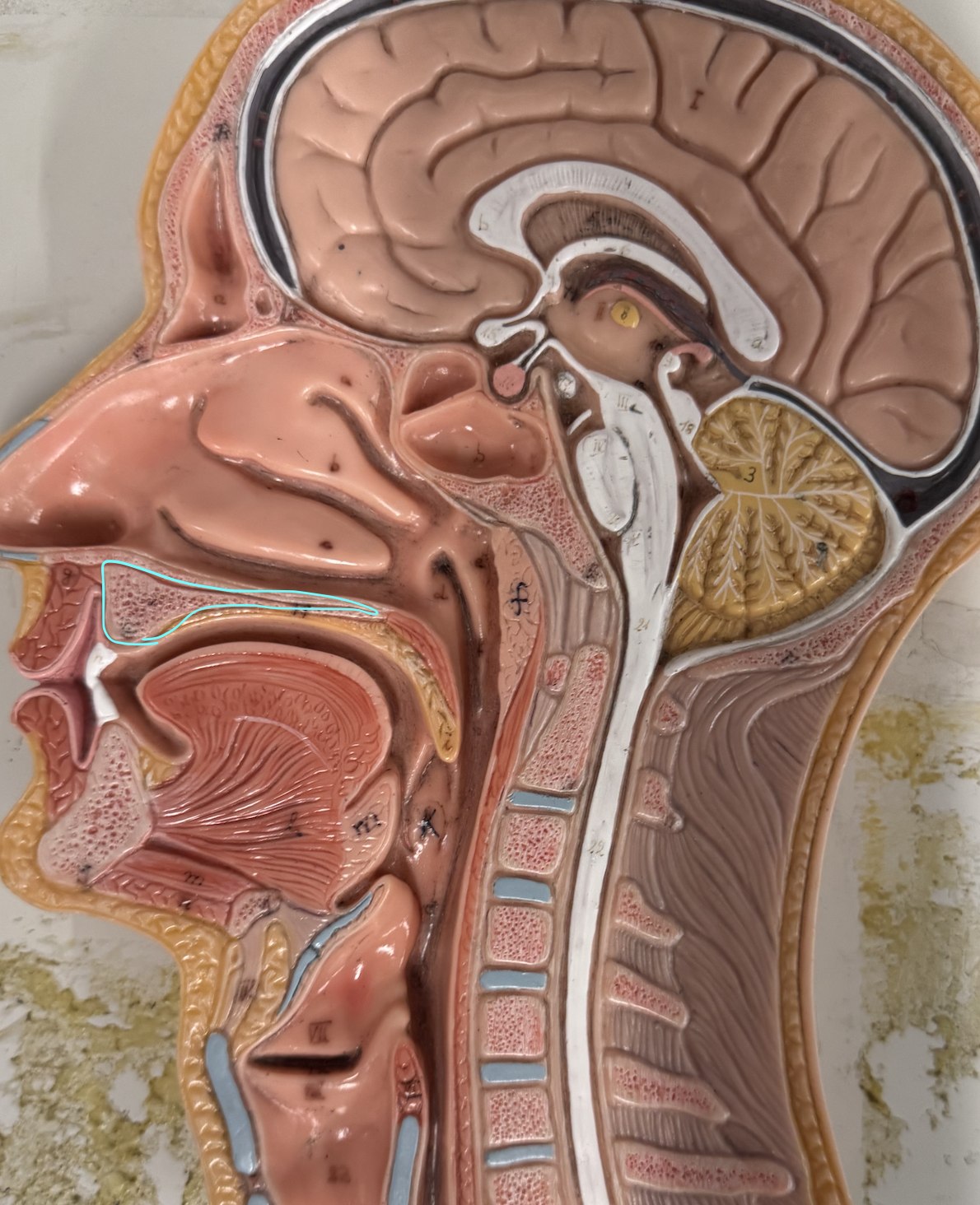 <p>Bony</p><p>forms root of oral cavity + plays an important role in swallowing</p>