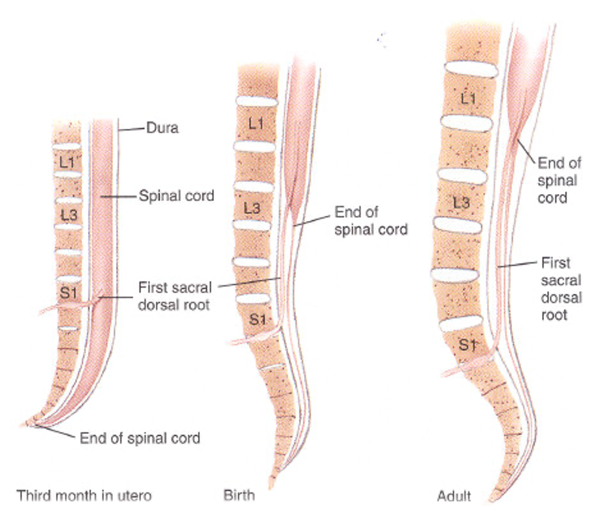 <ul><li><p>spinal cord lines up with end of vertebrae</p></li><li><p>as we get older, the spinal cord ends around L1 but the bone continues to grrow</p><ul><li><p>leaving a part of the spinal cord you can draw CSF fluid from (spinal tap/lumbar puncture)</p></li></ul></li></ul><p></p>