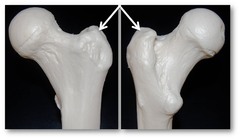 <p>very large, irregularly shaped process (ONLY on the femur)</p>