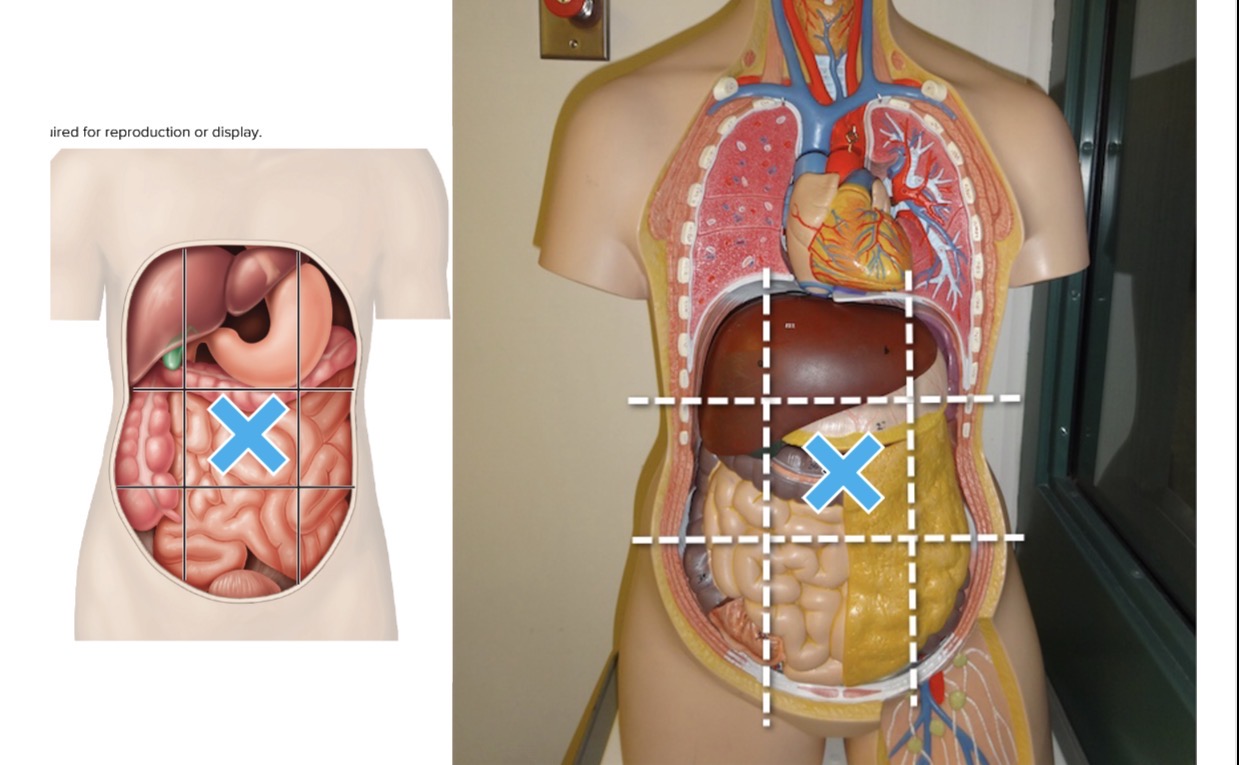 <p>Name the abdominopelvic region the mark is in</p>