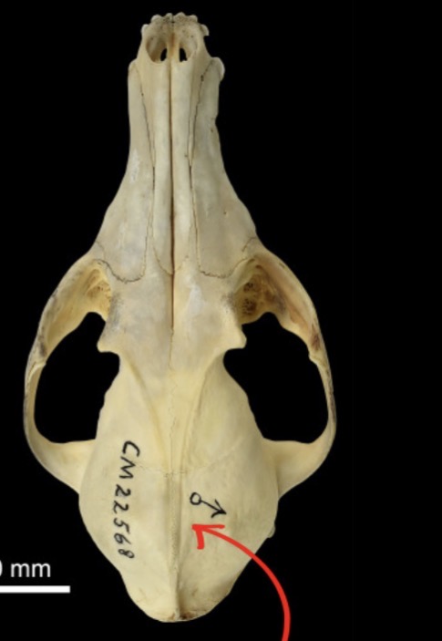 <p>V-shaped temporal line</p>
