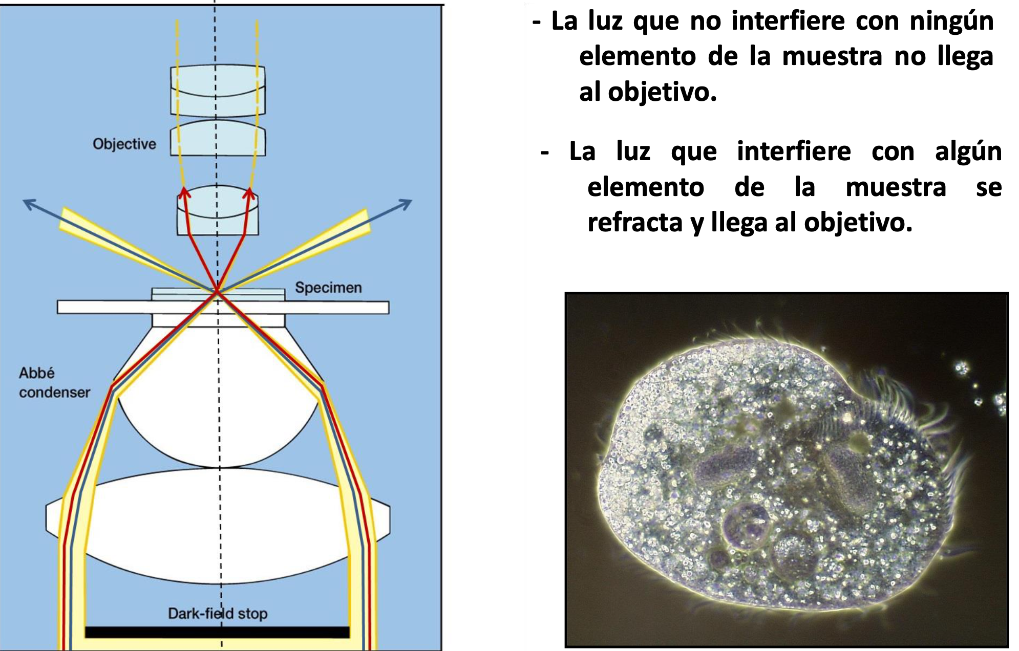 <p>Microscopía óptica convencional vs <strong>campo oscuro</strong></p>