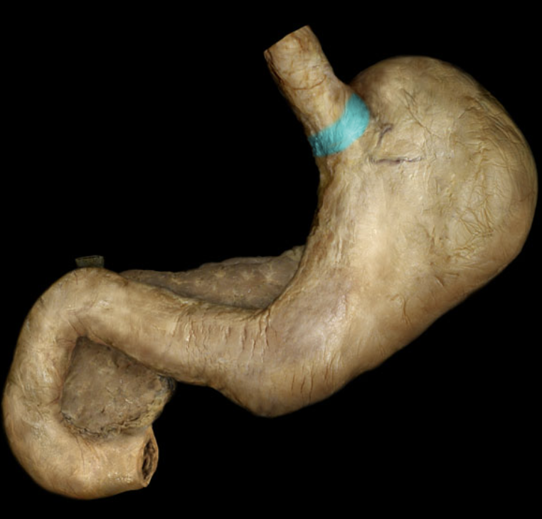 term image