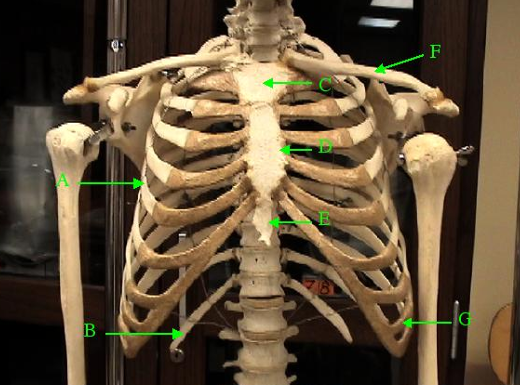 <p>Identify structure labelled C and the bone it is part of.</p>