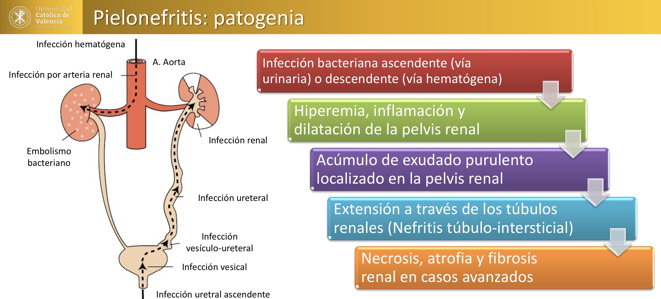 <p>RENAL: pielonefritis: pielectasia e hiperemia hacia la corteza renal </p><p>Pielonefritis purulenta asociada a Urolitiasis e hiperplasia prostatica </p>