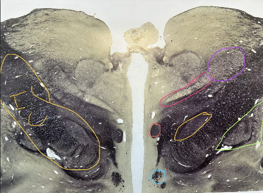 <p>whats in salmon</p>