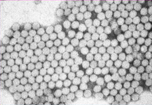 <p>Describe the <strong>Source </strong>of this waterborne virus:</p><p>-<strong>Hepatitis A</strong></p>