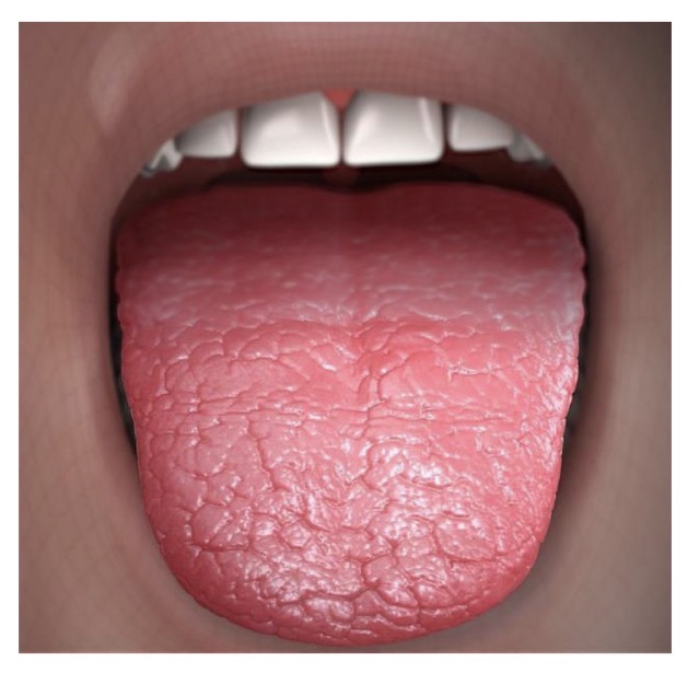 <p>CHẨN ĐOÁN?</p>