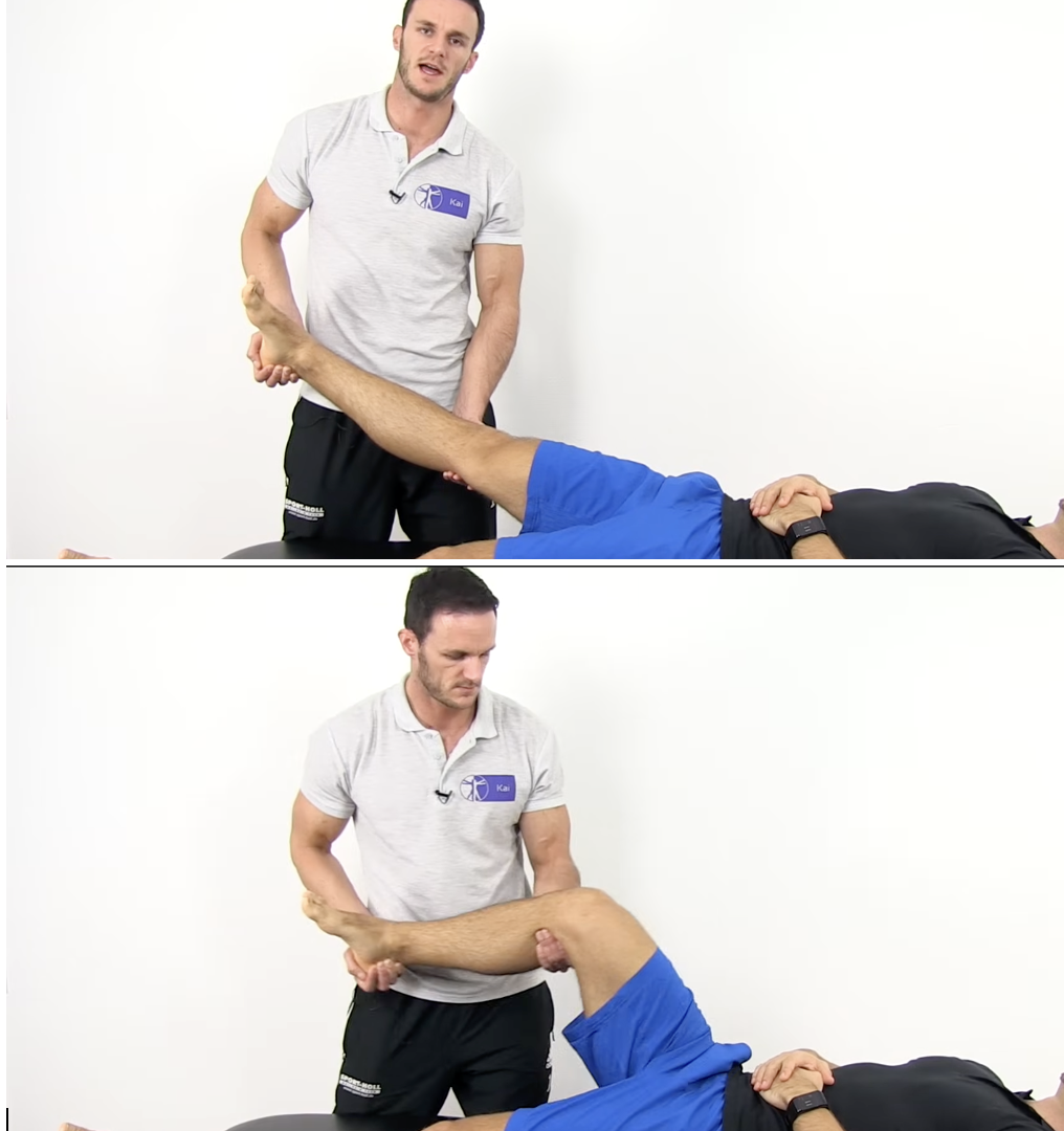 <p>LIGAMENTOUS STABILITY (anterior instability)</p><p><strong>Purpose</strong></p><ul><li><p><span style="color: red;"><strong>ACL tear</strong></span></p></li><li><p><span style="color: red;"><strong>Anterolateral rotary instability</strong></span></p></li><li><p><span style="color: blue;">Assesses dynamic anterior subluxation and reduction of the tibia in an ACL-deficient knee - youtube</span></p></li><li><p><span style="color: blue;">Assesses anterolateral rotatory instability/anterior translation of the tibia relative to the femur - CPG</span></p></li></ul><div data-type="horizontalRule"><hr></div><p><strong>How to perform - Youtube</strong></p><ol><li><p>pt supine w/ the hip flexed and abducted 30°</p></li><li><p>Grasp the calcaneus from the outside to create tibial IR (some authors add axial compression)</p></li><li><p>Apply a slight valgus force at the level of the fibula</p></li><li><p>Move the knee from extension into flexion while maintaining the forces</p></li></ol><p></p><p><strong>How to perform - CPG</strong></p><ol><li><p class="">pt supine w/ knee fully extended</p></li><li><p class="">IR the tibia holding at the ankle w/ hand 1</p></li><li><p class="">Place hand 2 on the lateral aspect of the proximal tibia</p></li><li><p class="">Apply a valgus stress while slowly flexing the knee from full extension</p></li><li><p class="">Look for a sudden reduction at approximately 20° of knee flexion = ACL tear</p></li></ol><div data-type="horizontalRule"><hr></div><p><strong>Positive test - Youtube</strong></p><ul><li><p><span style="color: red;"><strong>The tibia reduces or drops posteriorly at approximately 30–40° knee flexion as the IT band tightens</strong></span></p></li><li><p><span style="color: red;"><strong>A palpable or audible clunk may occur</strong></span></p></li><li><p><span style="color: red;"><strong>The patient may report the familiar giving-way sensation experienced during walking</strong></span></p></li></ul><p></p><p><strong>Positive test - CPG</strong></p><ul><li><p><span style="color: red;"><strong>A sudden clunk or shift as the anteriorly subluxed lateral tibial plateau reduces at approximately 20° knee flexion = ACL disruption</strong></span></p></li><li><p>Grading</p><ul><li><p>Normal = equal/no shift</p></li><li><p>Grade 1 = glide</p></li><li><p>Grade 2 = clunk</p></li><li><p>Grade 3 = gross/severe shift</p></li></ul></li></ul><p></p>