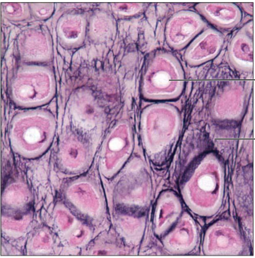 <p>Similar to hyaline cartilage, but more elastic fibers in matrix. Maintains the shape of a structure while allowing great flexibility. Supports the external ear (pinna); epiglottis.</p>