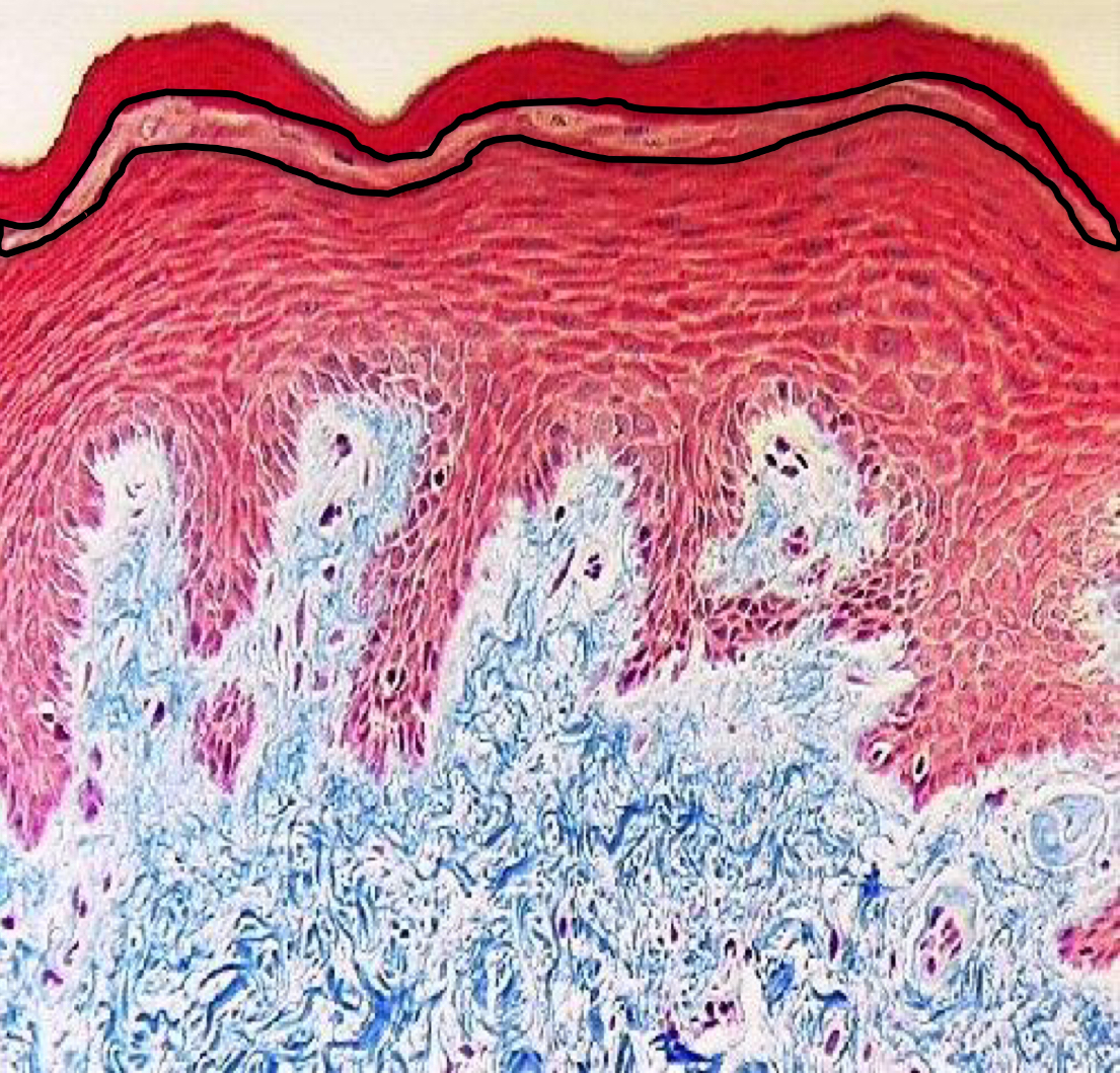 <p>What layer of the epidermis is this?</p>