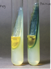 <p>purpose: detect whether orgnanism can make phenylalanine deanimase enzyme as source of carbon/energy</p><p>ingredients: NaCl, 10% ferric chloride (reagent), L-phenylalanine, agar</p><p>if phenylalanine deanimase enzyme present, will break down phenylalanine into phenylpyruvic acid and ammonia</p><p>add the 10% ferric chloride</p><p>it will react with phenyl pyruvic acid (if its present) and turn green --> positive result</p><p>if yellow --> negative as it wasnt able to break down phenylalanine</p>