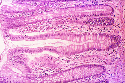 <p>Simple tubular gland</p>