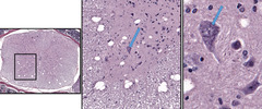<p>Identify the Basophilic material in the cytoplasm of this cell</p>