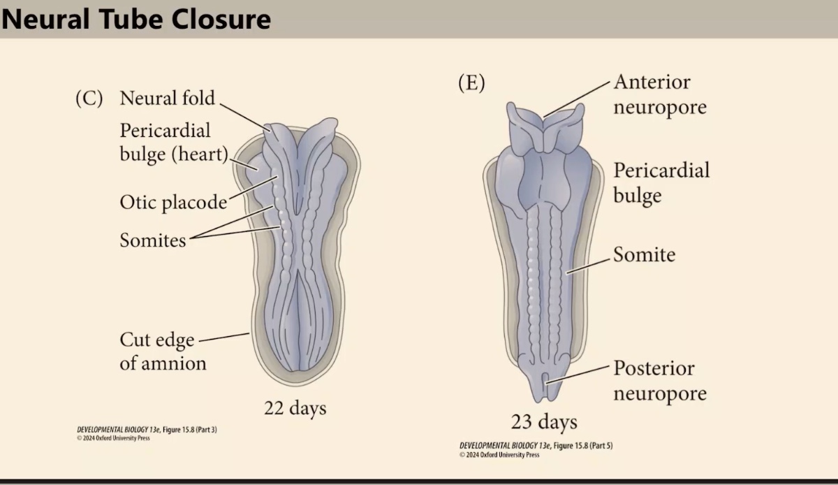 <p>What are the names of the open canals at the ends of the neural tube during the zipping process?</p>