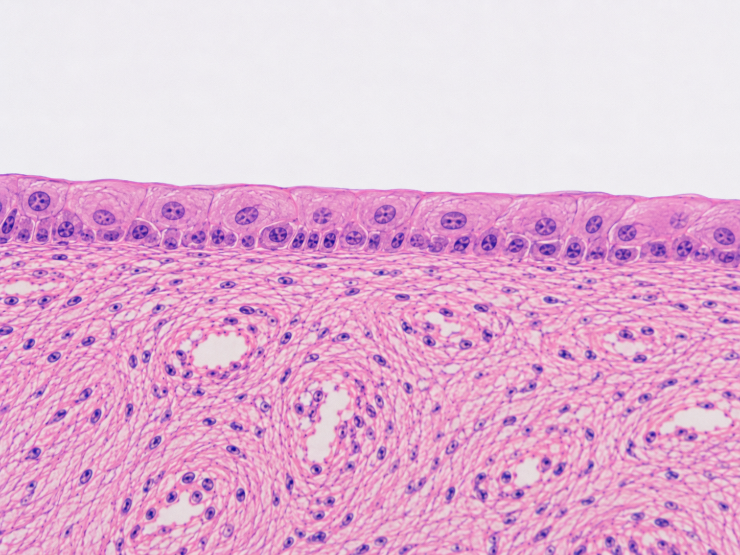 <p>What type of Epithelial Tissue is this?</p>