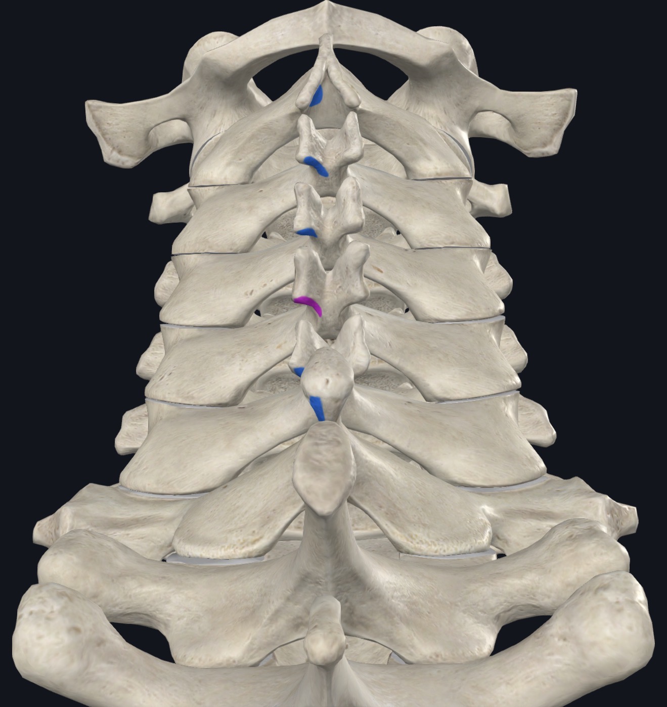 <p>Inferior surfaces of spinous processes of vertebra to vertebra of proximal attachmentI</p>