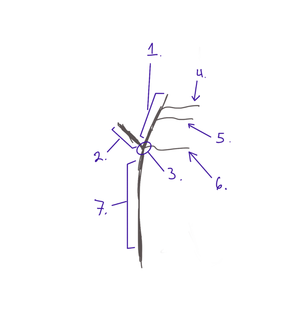 <p>Structure. Most medial branch on the Y. #5</p>