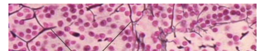 <p>What is this Connective Tissue? and where is it found ?</p>