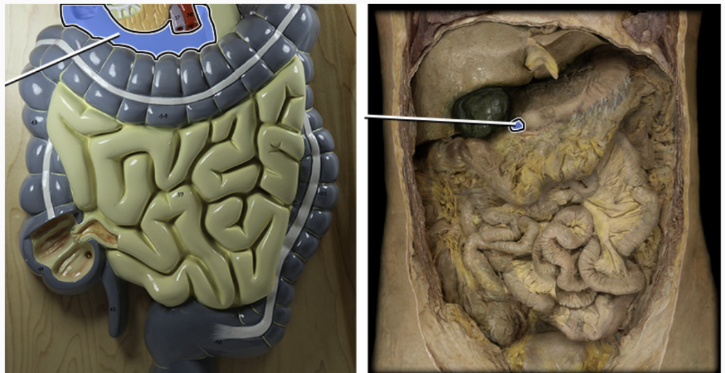 <p><span style="background-color: transparent;">Duodenum</span></p>