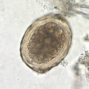 <p>Charateristics mammalated (nodulated呈结节状的)outer shell</p>