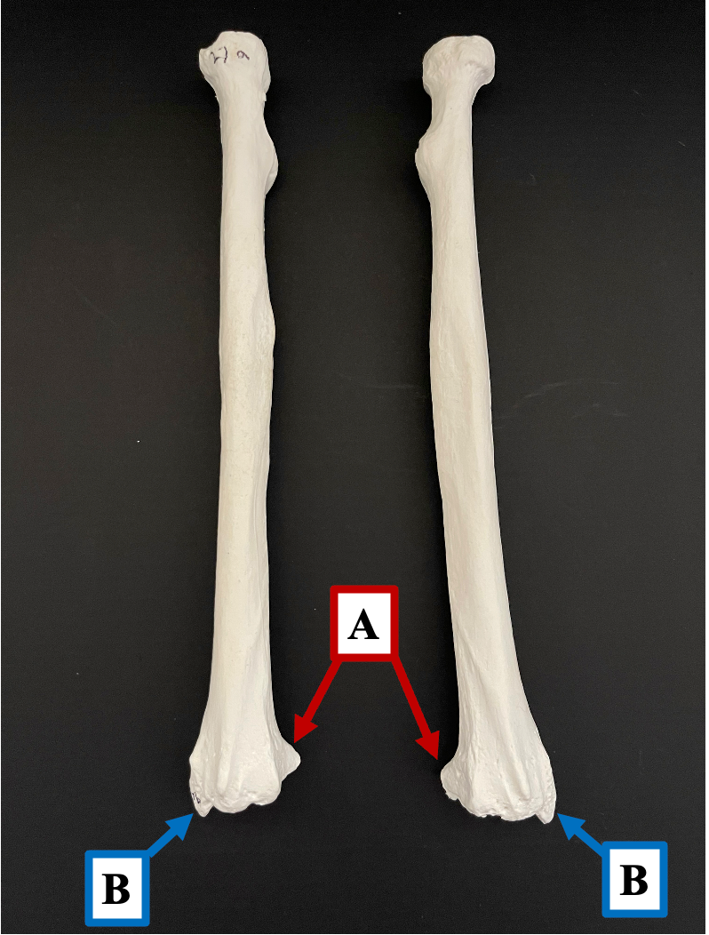 <p>Identify the bony landmark of the radius that label <strong>B </strong>is pointing to.</p>