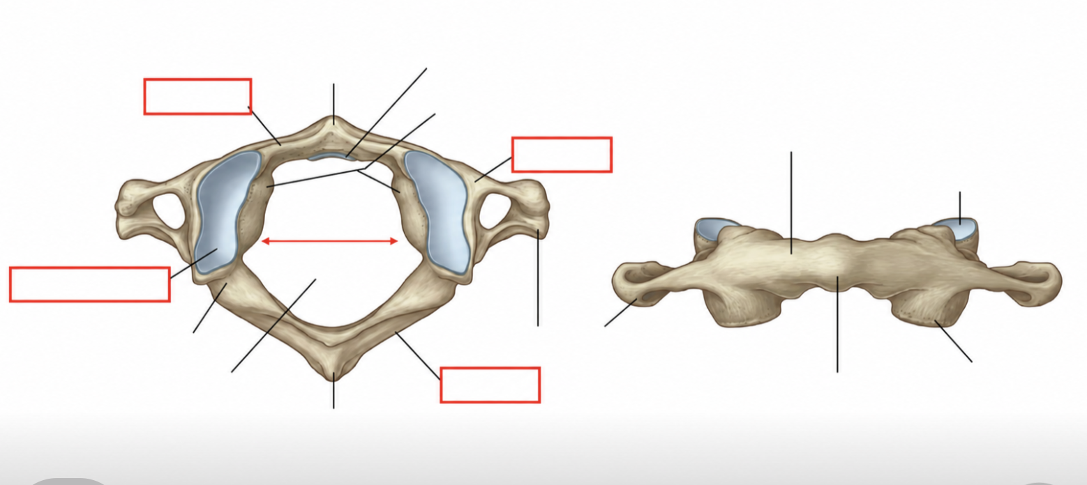 <p>What is C1 called, what are the main markings on it (label the diagram), what head movement does it support, what is it missing that other C1’s have</p>