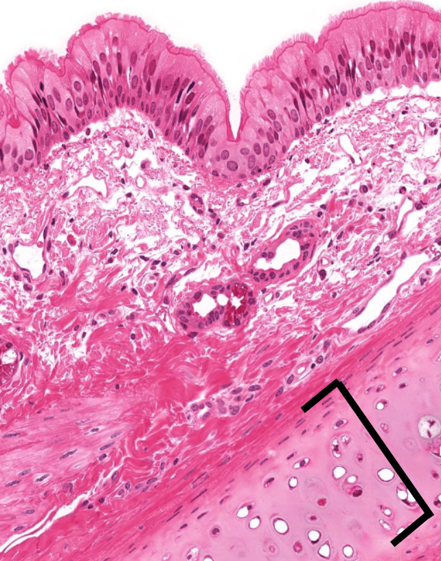 <p>identify the tissue</p>