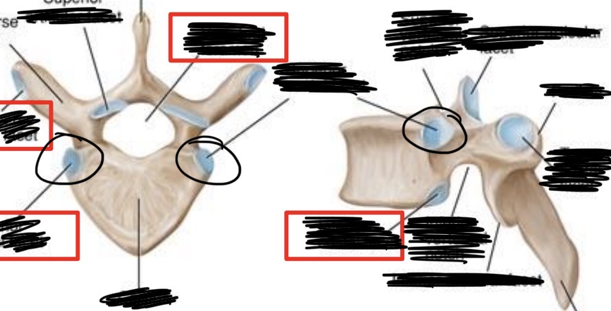 <p>What is this part of the thoracic vertebrae?</p>
